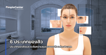 ประเภทสิว ชนิดของ สิว แต่ละประเภท ประเภทของสิว มีกี่ชนิด