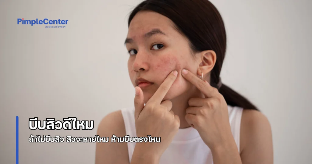 บีบสิว